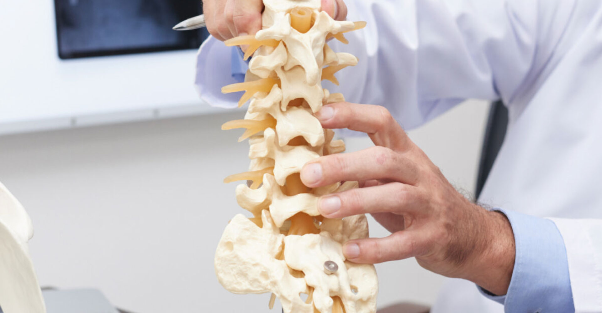 Scoliosi e Iperlassità Legamentosa (Caso Studio)